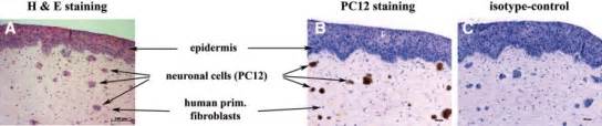 A primary infection with hsv is often. Cross sections of the HSV-1 infection model with ...