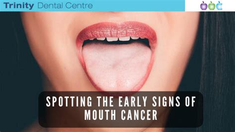 Spotting The Early Signs Of Mouth Cancer
