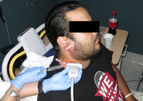 Facehead And Neck — Highland Em Ultrasound Fueled Pain Management