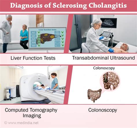 Sclerosing Cholangitis Types Causes Symptoms Diagnosis Treatment