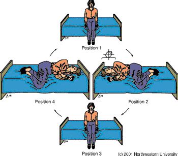 The epley maneuver, however, can dislodge these crystals and remove them from the semicircular the epley maneuver is often effective for many patients with bppv, especially in cases where. brandt daroff exercise | E.N.T. Care and Cure