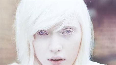 Utra White Hair And Skin 100 Albino Hypnosis