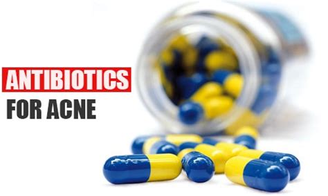 4 Best Oral Antibiotics For Acne Whydoihaveacne