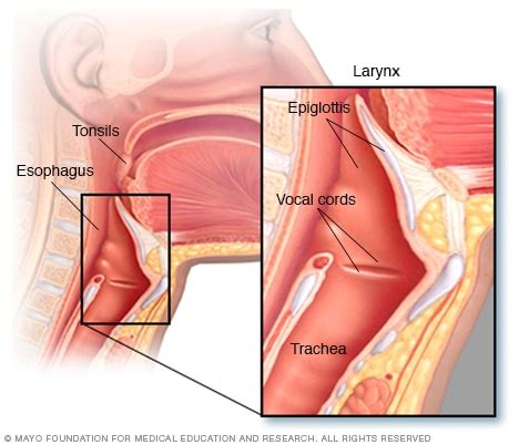 Throat cancer will start with initial symptoms such as a coughing, difficulty in swallowing and changes in the voice, which all are similar to the symptoms of cold and sore throat. Dolor de garganta - Síntomas y causas - Mayo Clinic
