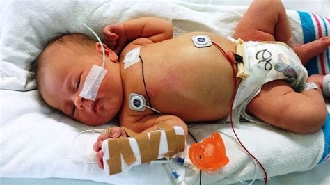 10 Danger Signs In Babies Every Parents Must Know Epomedicine
