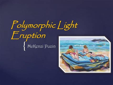 Ppt Polymorphic Light Eruption Powerpoint Presentation Free Download
