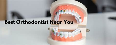 Finding The Best Orthodontist Near Me The Best Us Clinics