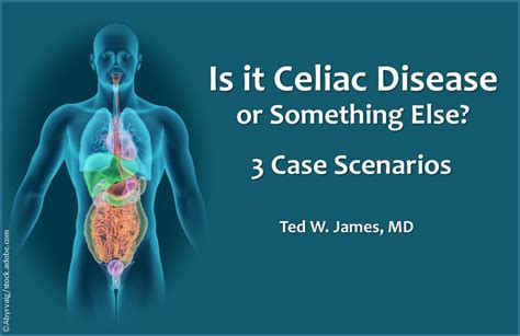 Is It Celiac Disease Or Something Else Patient Care Online