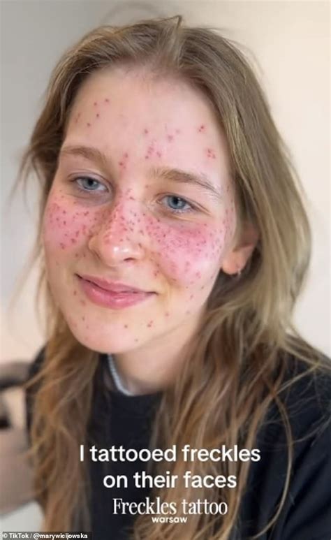 Would You Try The Faux Freckle Trend New Beauty Treatment Sees Women