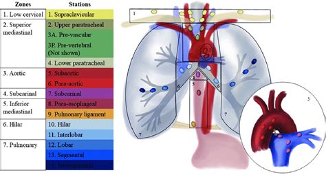 Illustration Shows Mediastinal And Hilar Lymph Node Stations On The