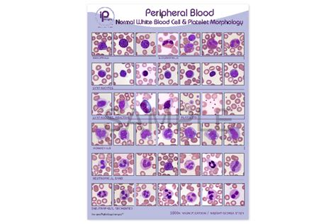 Peripheral Blood Normal White Blood Cell And Platelet