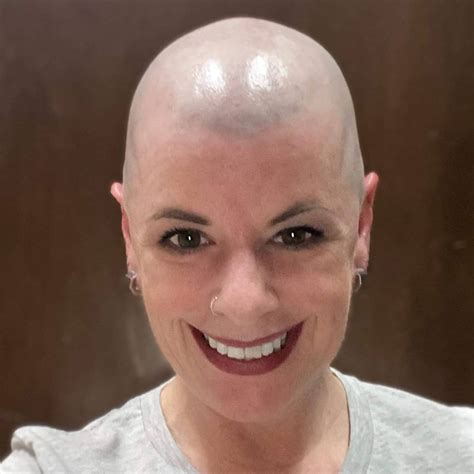 Bald Woman By Choices Instagram Post “i Have Dyed My Hair Every Color You Can Think Of Pink