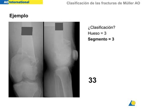 Clasificación Ao Traumatologia