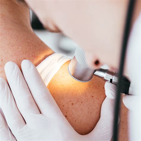 Comprehensive Review Of Dermatology Dermatology Cme
