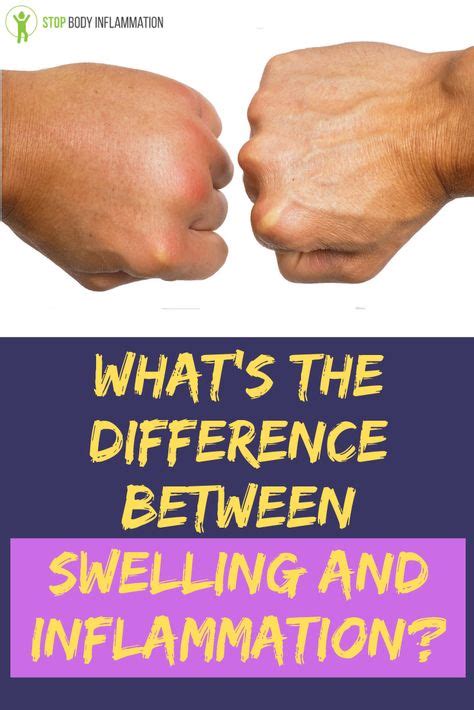 Whats The Difference Between Swelling And Inflammation