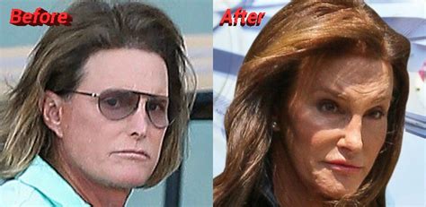 bruce jenner plastic surgery from male athlete to female star