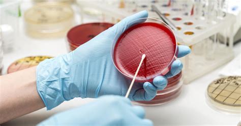 Urine Culture And Sensitivity Labcorpprice Plans