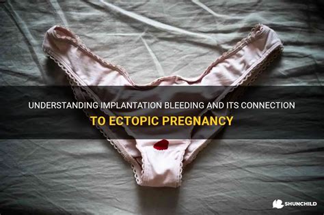 Understanding Implantation Bleeding And Its Connection To Ectopic