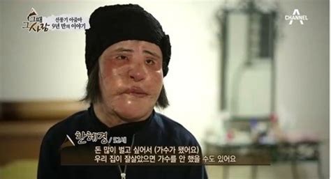 한국 성형 실패 “선풍기 아줌마” 젊을 때 미인사진 공개 인민넷 조문판 人民网