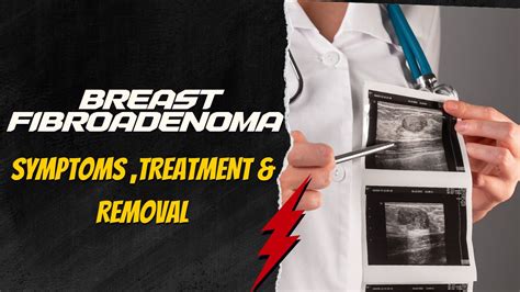 Breast Fibroadenoma Symptoms Treatment And Removal