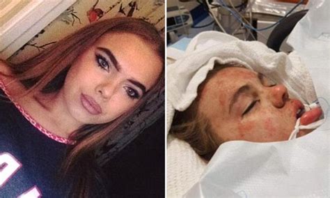 Leah Robinson Says She Is Lucky After First Ever Ecstasy Pill Put Her In Coma Daily Mail Online