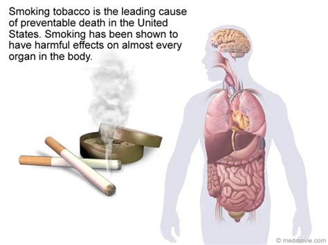💣 Cause And Effect Of Smoking Causes And Effects Of Smoking In Public