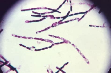 Gram Positive Endospore Forming Bacteria
