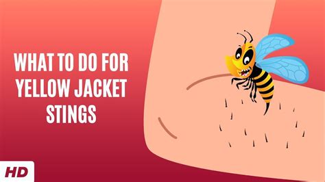 What To Do For Yellow Jacket Stings Youtube