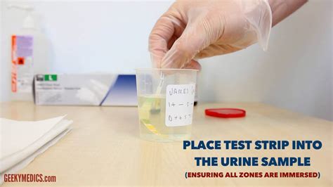 Urinalysis Osce Guide Urine Dipstick Geeky Medics