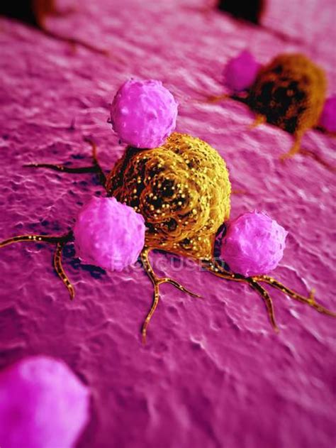 Cancer Cells And White Blood Cells — Artwork 3d Stock Photo 160554056