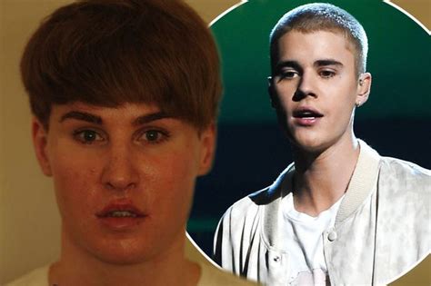 Justin Bieber Look Alike Toby Sheldon Who Spent 100000 On Surgery