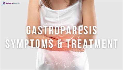 Do You Have Gastroparesis Symptoms Treatment Options And Whats Next
