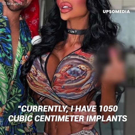 The Model Who Is Obsessed With Plastic Surgeries “i Have Spent More Than 200 Thousand Dollars