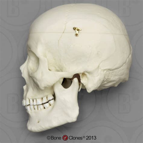 Bone Clones Human Male Asian Skull With Calvarium Cut Replica Bc 092