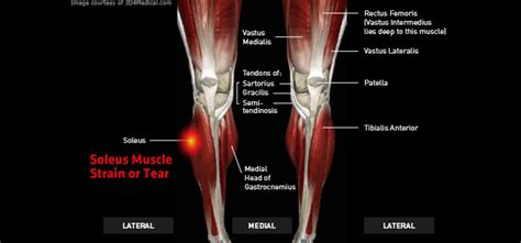 The tendon continues along the lateral side of. Soleus Muscle Strain or Tear - Thermoskin - Supports and ...
