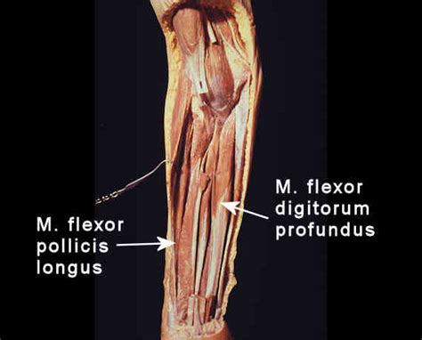 Flexor Pollicis Longus Cadaver