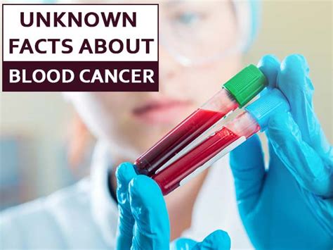 8 Unknown Facts Of Blood Cancer That You Should Know