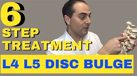 6 Step L4 L5 Disc Bulge Treatment L4 L5 Bulging Disc Treatment By Dr