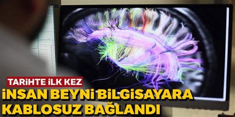 İnsan beyni kablo olmadan bilgisayara bağlandı