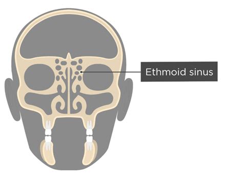 Figure Diagram Of The Frontal Sinus Anatomy Coronal Contributed By