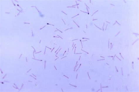 Clostridium Tertium