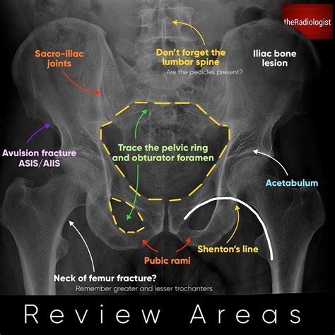 Pelvis X Ray Anatomy