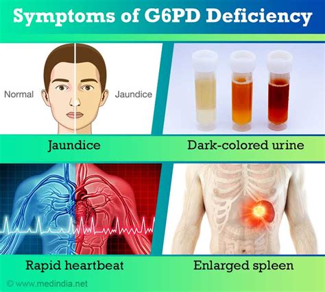What Is A G6pd Deficiency