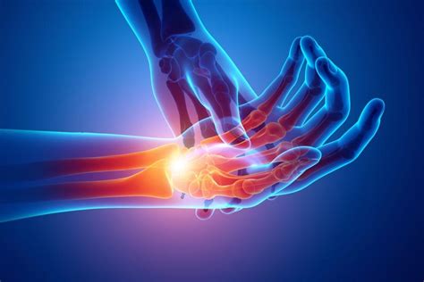 Hand And Wrist Pain Specialist Palm Harbor Fl Orthopedic Specialists