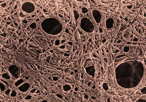 Cytoskeleton Of Tissue Culture Cells Tem Stock Image C0282707 Science Photo Library