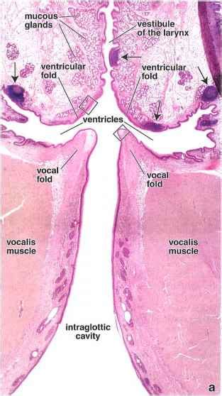 Pic Of Vocal Fold