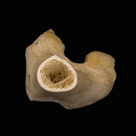 Bone Cross Section Lm Photograph By Science Stock Photography Fine