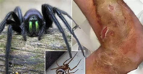 Creepy Army Of Irelands Most Dangerous Spiders Set To Invade Homes In