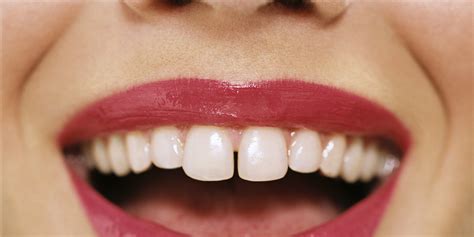 What The Color Size Shape And Feel Of Your Gums Say About Your