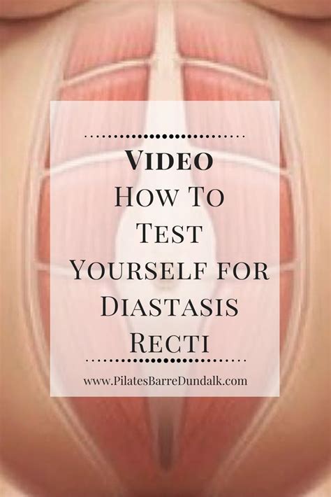 Diastasis Recti Self Test For Postpartum Recovery